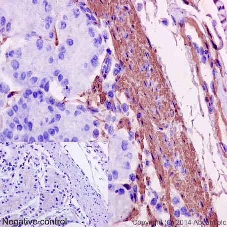 Immunohistochemistry (Formalin/PFA-fixed paraffin-embedded sections) analysis of human stomach tissue labelling alpha smooth muscl Actin with purified ab124964 at 1/1000. Heat mediated antigen retrieval was performed using Tris/EDTA buffer pH 9. A prediluted HRP-polymer conjugated anti-rabbit IgG was used as the secondary antibody. Negative control using PBS instead of primary antibody. Counterstained with Hematoxylin.