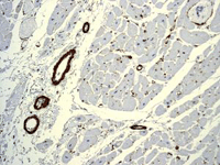Immunohistochemistry (Formalin/PFA-fixed paraffin-embedded sections) analysis of human heart tissue labelling alpha smooth muscle actin with unpurified ab124964 at 1/1000 dilution.