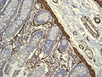 Immunohistochemistry (Formalin/PFA-fixed paraffin-embedded sections) analysis of human ovary tissue labelling alpha smooth muscle Actin with unpurified ab124964 at 1/1000 dilution.