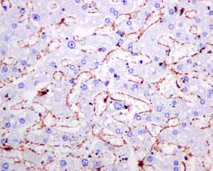 Immunohistochemistry (Formalin/PFA-fixed paraffin-embedded sections) analysis of normal human liver vessels tissue labelling alpha smooth muscle Actin with unpurified ab124964.