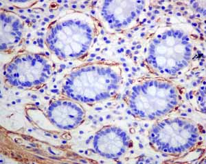 Immunohistochemistry (Formalin/PFA-fixed paraffin-embedded sections) analysis of normal human colon smooth muscle tissue labelling alpha smooth muscle Actin with unpurified ab124964.