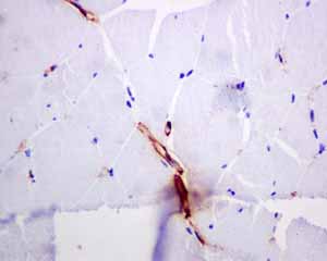 Immunohistochemistry (Formalin/PFA-fixed paraffin-embedded sections) analysis of normal human skeletal muscle vessels tissue labelling alpha smooth muscle Actin with unpurified ab124964.
