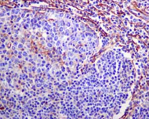Immunohistochemistry (Formalin/PFA-fixed paraffin-embedded sections) analysis of normal human tonsil vessels tissue labelling alpha smooth muscle Actin with unpurified ab124964.