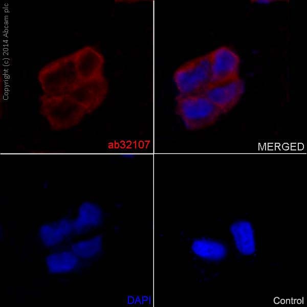 Immunocytochemistry/Immunofluorescence analysis of A673 cells labelling alpha smooth muscle Actin with purified ab124964 at 1/300. Cells were fixed with 4% paraformaldehyde. An Alexa Fluor® 555-conjugated goat anti-rabbit IgG (1/500) was used as the secondary antibody. DAPI (blue) was used as the nuclear counterstain.Control: primary antibody (1/300) and secondary antibody, ab150113, an Alexa Fluor® 488-conjugated goat anti-mouse IgG (1/500).