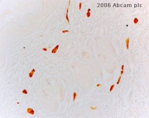 ab15267 (used X1) staining day 3 wounded rat skin tissue by IHC-P. The tissue was formaldehyde fixed and blocked with peroxidase prior to incubation with the antibody for 25 minutes. An HRP conuugated goat polyclonal antibody was used as the secondary.See Abreview