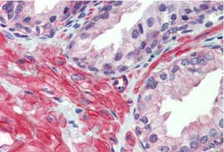 Immunohistochemical analysis of paraffin embedded Human prostate tissue labelling 5HT2C Receptor with ab134389 antibody at a concentration of 10 µg/ml, followed by biotinylated secondary antibody, alkaline phosphatase-streptavidin and chromogen.