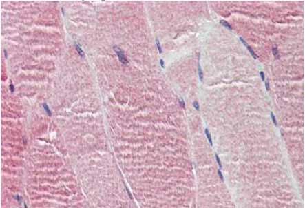 Immunohistochemical analysis of paraffin embedded Human skeletal muscle tissue labelling 5HT2C Receptor with ab134389 antibody at a concentration of 10 µg/ml, followed by biotinylated secondary antibody, alkaline phosphatase-streptavidin and chromogen.