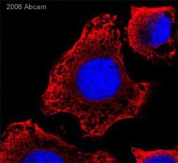 ab11304 at a 1/100 dilution staining human HeLa cells by Immunocytochemistry/Immunofluorescence. The cells were methanol fixed and blocked for 1 hour with 10% serum. The antibody was then incubated with the cells for 1 hour. Bound antibody was detected using a Goat anti-mouse TRITC antibody. See Abreview