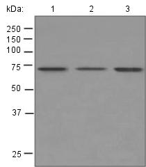 All lanes : Anti-5HT2C Receptor antibody [EPR6486] (ab124951) at 1/1000 dilutionLane 1 : SH-SY5Y cell lysateLane 2 : A431 cell lysateLane 3 : BxPC-3 cell lysateLysates/proteins at 10 µg per lane.Secondarystandard HRP labelled goat anti-rabbit at 1/2000 dilution