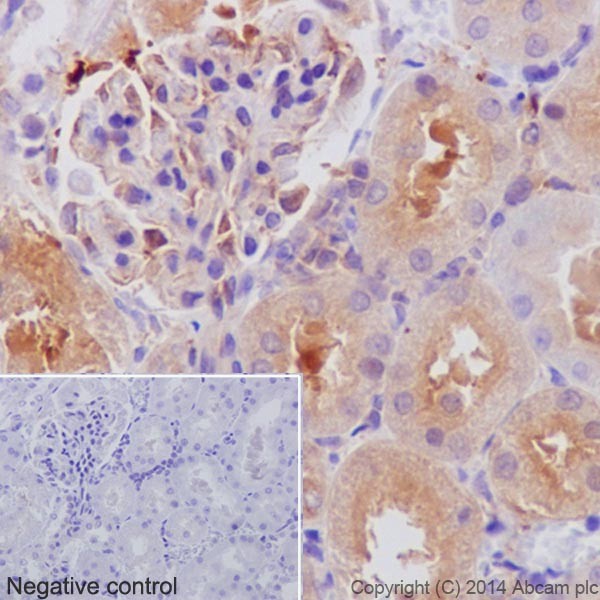 Immunohistochemistry analysis of paraffin-embedded Rat kidney tissue labeling alpha Tubulin with ab52866 at a 1/1000 dilution. Cytoplasmic staining on Rat kidney tubule and weak on glomerulus shown. Secondary antibody Anti-Rabbit HRP (ab97051) used at a 1/500 dilution. Counter stained with Hematoxylin.Inset image: negative control obtained using PBS instead of ab52866, secondary antibody is Anti-Rabbit HRP (ab97051) at 1/500 dilution.