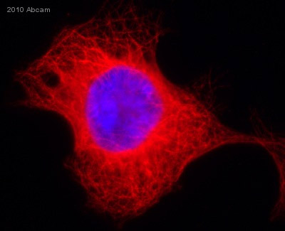 ab52866 staining alpha Tubulin in 293 Human embryonic kidney cells by ICC/IF (Immunocytochemistry/immunofluorescence). Cells were fixed with paraformaldehyde and blocked with 10% serum for 2 hours at 23°C. Samples were incubated with primary antibody (1/200 in 0.5% saponin) for 2 hours at 23°C. An Alexa Fluor®555-conjugated Goat anti-rabbit IgG polyclonal (1/500) was used as the secondary antibody. Nuclei were counterstained with DAPI.See Abreview