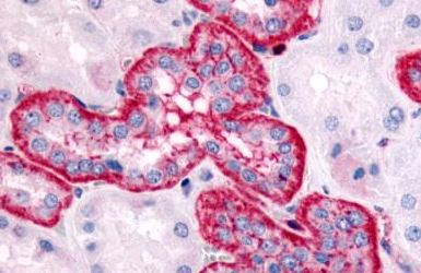 Immunohistochemical analysis of formalin fixed, paraffin embedded Human kidney, renal tubules tissue labelling 5HT2C Receptor with ab140516 at 3.8 µg/ml.