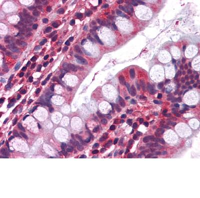 ab111983, at 3.75µg/ml, staining 5HT3A receptor in Formalin-fixed, Paraffin-embedded Human Small intestine tissue by Immunohistochemistry.