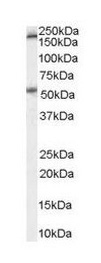 Anti-5HT3A receptor antibody (ab111983) at 0.3 µg/ml + Human Colon lysate (in RIPA buffer) at 35 µgdeveloped using the ECL technique