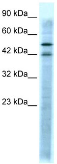Anti-5HT3A receptor antibody (ab104962) at 1 µg/ml + Jurkat cell lysate at 10 µg