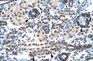 Immunohistochemistry (Formalin/PFA-fixed paraffin-embedded sections) analysis of human kidney tissue labelling 5HT3A with ab104962 at 4-8µg/ml. Positively labelled epithelial cells of the renal tube (arrows) and renal corpuscle (arrow heads). Magnification: 400X.