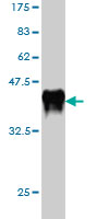 Western blot against tagged recombinant protein immunogen using ab57550 Als2 antibody at 1ug/ml.