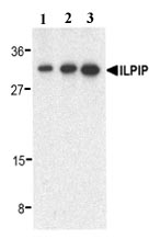 Lane 1 :  Anti-ALS2CR2 antibody (ab17205) at 0.5 µg/mlLane 2 :  Anti-ALS2CR2 antibody (ab17205) at 1 µg/mlLane 3 :  Anti-ALS2CR2 antibody (ab17205) at 2 µg/mlLane 1 : Human heart lysateLane 2 : Human heart lysateLane 3 : Human heart lysateObserved band size : 34 kDa (why is the actual band size different from the predicted?)