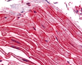 ab17205 at 5µg/ml staining ALS2CR2 in human heart tissue by IHC