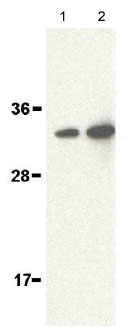 Lane 1 :  Anti-ALS2CR2 antibody (ab62340) at 1 µg/mlLane 2 :  Anti-ALS2CR2 antibody (ab62340) at 2 µg/mlLane 1 : human brain lysateLane 2 : human brain lysate