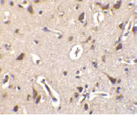 ab62340 at 10 µg/ml staining human brain tissue by IHC-P.