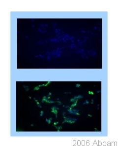 HEK 293 cells transfected with 5HT3B receptor were stained with ab39629 diluted 1/500 and anti-rabbit secondary antibody conjugated to Alexa Fluor 488 diluted 1/1000(green). Nuclei are labelled with Hoescht 33258 (blue).