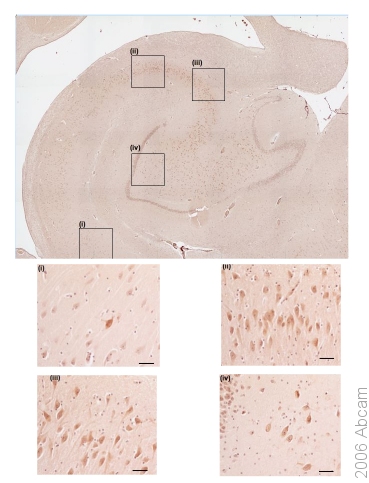 Immunohistochemistry of human hippocampus stained with ab39269 diluted 1/500. Immunoreactivity with 5HT3B receptor can be seen in (i)CA1 field, (ii)CA2, (iii)CA3 and (iv)CA4/dentate gyrus.