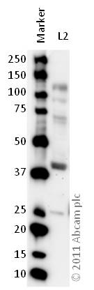 All lanes : Anti-5HT4 Receptor antibody (ab60359) at 1/500 dilutionLane 1 : MarkerLane 2 : Zebrafish brain homogenate at 20 µgSecondaryGoat polyclonal to Rabbit IgG – H&L – Pre-Adsorbed (HRP) at 1/6000 dilutiondeveloped using the ECL techniquePerformed under reducing conditions.