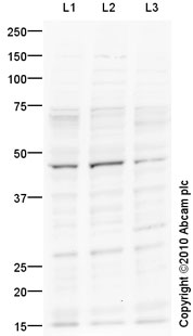 All lanes : Anti-5HT4 Receptor antibody (ab87337) at 2 µg/mlLane 1 : Caco 2 (Human colonic carcinoma cell line) Whole Cell Lysate Lane 2 : SW480 (Human colon adenocarcinoma cell line) Whole Cell Lysate Lane 3 : HeLa (Human epithelial carcinoma cell line) Whole Cell Lysate Lysates/proteins at 10 µg per lane.SecondaryGoat polyclonal Secondary Antibody to Rabbit IgG - H&L (HRP), pre-adsorbed at 1/5000 dilutiondeveloped using the ECL techniquePerformed under reducing conditions.
