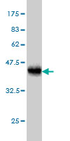 Western blot against tagged recombinant protein immunogen using ab54787 AMFR antibody at 1ug/ml.