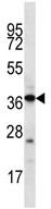 Anti-5HT4 Receptor antibody (ab113004) at 1/100 dilution + Mouse liver tissue lysate at 35 µg