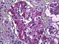 ab124642, at 10µg/ml, staining 5HT4 Receptor in Formalin-fixed, Paraffin-embedded Human adrenal tissue by Immunohistochemistry.
