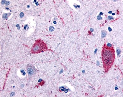 Immunohistochemical analysis of formalin-fixed, paraffin-embedded Human brain cortex tissue, staining 5HT5A receptor with ab61002 at 5 µg/ml.
