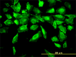 Aminoacylase 1 antibody (ab54960) used in immunofluorescence at 10ug/ml on HeLa cells.