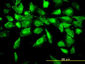 ab117466, at 10µg/ml, staining Aminoacylase 1 in HeLa cells by Immunofluorescence.