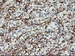 ab119839, at 1/150, staining Aminopeptidase A in paraffin embedded Human liver tissue by Immunohistochemistry.