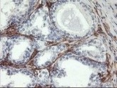 ab119839, at 1/150, staining Aminopeptidase A in paraffin embedded Human prostate tissue by Immunohistochemistry.