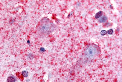 Immunohistochemical analysis of formalin-fixed, paraffin-embedded Human brain cortex tissue, staining 5HT7 Receptor with ab61562 at 10 µg/ml. 
