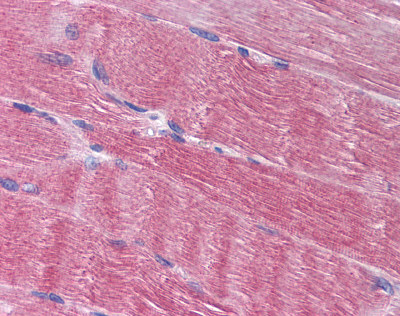 Immunohistochemistry analysis of formalin-fixed, paraffin-embedded skeletal muscle tissue using 10 ?g/ml ab78045.