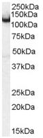 Anti-Amphiphysin antibody (ab50340) at 0.1 µg/ml + Mouse Brain lysate (35µg protein in RIPA buffer).