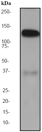 Anti-Amphiphysin antibody [EP2060Y] (ab52646) at 1/100000 dilution + Human brain lysate at 10 µgSecondaryGoat anti-Rabbit HRP labeled at 1/2000 dilution