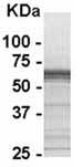 Anti-Amphiregulin antibody (ab37803) at 1/2000 dilution + E. coli derived fusion protein at 2.5 µgSecondaryHRP conjugated Goat anti IgY at 1/1000 dilution