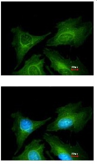 Immunofluorescence analysis of methanol-fixed HeLa cells, labelling 5HT7 Receptor with ab137493 at 1/200 dilution. The lower image is co-stained with Hoechst 33342.