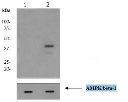 All lanes : Anti-AMPK beta 1 (phospho S181) antibody [EP2181Y] (ab68206) at 1/20000 dilutionLane 1 : human brain tissue lysate (cells were untreated)Lane 2 : human brain tissue lysate (cells were treated with AP)Lysates/proteins at 10 µg per lane.SecondaryHRP labelled goat anti-rabbit at 1/2000 dilution