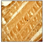 Immunohistochemical analysis of paraffin-embedded human skeletal muscle using ab68206 at 1/100-1/250 dilution.