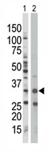 All lanes : Anti-AMPK beta 1 antibody - Aminoterminal end (ab70922) at 1/100 dilutionLane 1 : Jurkat cell lysateLane 2 : Mouse spleen tissue lysateLysates/proteins at 12.5 µg per lane.