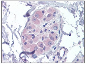 ab110141, at 3.75 µg/ml, staining PRKAB2 in Human small intestine (submucosal plexus) tissue by immunohistochemistry. After incubation with ab110141, slides were incubated with biotinylated secondary antibody, followed by alkaline phosphatase-streptavidin and chromogen.