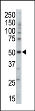 Anti-AMPK gamma 3 antibody (ab38228) at 1/100 dilution + mouse brain tissue lysateSecondaryHRP-anti-rabbitdeveloped using the ECL technique