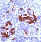 ab15125 staining Amylin in human pancreas by Immunohistochemistry (Formalin/ PFA fixed paraffin embedded tissue sections).