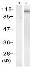 All lanes : Anti-Androgen Receptor (phospho S213) antibody (ab131346) at 1/500 dilutionLane 1 : DU145 cell extracts with immunizing peptideLane 2 : DU145 cell extracts